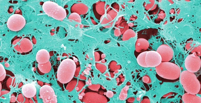 Cellulose im E.coli-Biofilm
